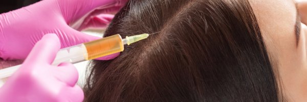 PRP Saç Tedavisi Nedir?