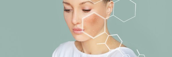 Cilt Lekeleri Neden Oluşur?