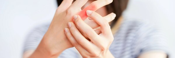 Sedef Hastalığı (Psoriasis)